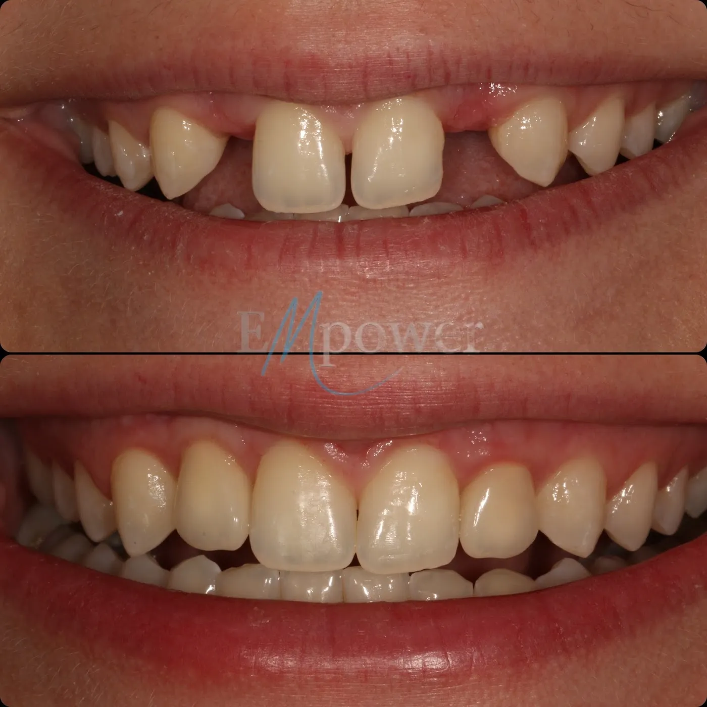 Empower Dental photo